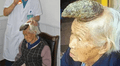 El insólito caso de la "abuela unicornio", la mujer china a la que le creció un cuerno de trece centímetros en la frente