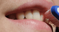 Científicos descubren una nueva solución para reparar los dientes dañados al usar un ingrediente peculiar