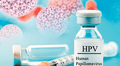 Minsa advierte: existen más de 200 tipos de VPH, algunos causan cáncer en hombres y mujeres
