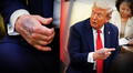 Trump aparece con moretones en las manos y genera preocupación por su estado de salud: ¿qué dicen los médicos?