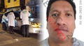 Sicarios asesinan al 'Loco Mere', abogado de 'Caracol', frente a su esposa e hija en el Callao
