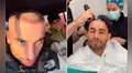 Said Palao impacta al mostrar su nueva imagen tras perder todo su cabello en tratamiento estético en España: “Esto recién empieza”