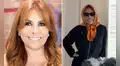 Magaly Medina responde a comentarios en redes por su reciente cirugía facial: "Estoy hinchada aún"