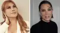 Magaly Medina confiesa que se hizo la misma cirugía que Kris Jenner, mamá de las Kardashian: “El presupuesto está por las nubes”