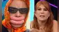 Jorge Benavides se pronuncia sobre la reacción de Magaly Medina por parodiar su cirugía estética: "A la señora no le ha gustado mucho"