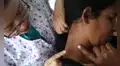 Alerta por cáncer de piel: 200 peruanos son derivados por sospecha de melanoma y Junín lidera casos