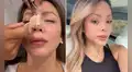 Sheyla Rojas muestra el resultado de su nueva rinoplastia tras retoque estético: "Quería que no me cambie la cara"