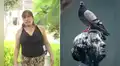 Mujer en VMT limpió excremento de paloma que cayó en su casa y perdió un dedo al contraer un hongo: "Era insoportable"