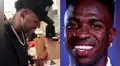 Revelan la impactante transformación facial de Vinicius Jr. tras someterse a cirugía de armonización de mentón