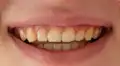 ¿Qué significa soñar que se te caen los dientes? Interpretaciones psicológicas y posibles explicaciones