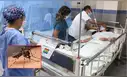 EsSalud alerta por síntomas graves del dengue: dolor abdominal y vómitos persistentes podrían indicar fase mortal