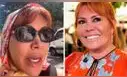 Magaly impacta con su cambio tras cirugía facial: "¿Cuánto cuesta para ir juntando?"