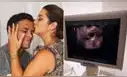 Karla Tarazona y Christian Domínguez acuden a clínica de fertilidad y sorprenden al mostrar ecografía