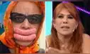 Jorge Benavides se pronuncia sobre la reacción de Magaly por parodiar su cirugía estética