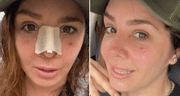 Yiddá Eslava comparte el resultado de su rinoplastia y explica por qué lo mantuvo en secreto: "Cambió mi vida"