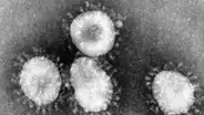 “No va a desaparecer”: virólogo dice que el coronavirus se quedará y será estacional