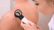 Manchas negras:¿Qué son y cómo curar sus apariciones en el cuello y axilas?