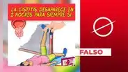 Es falso que la cistitis tenga una cura “para siempre”