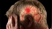 Científicos alertan riesgo de derrame cerebral relacionado con el coronavirus 