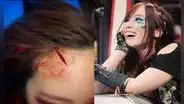 Luchadora de WWE terminó con terrible corte tras ser arrojada contra una escalera [VIDEO]