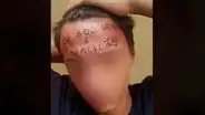 La verdadera historia del presunto ladrón que fue castigado con un tatuaje en la frente