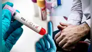 Cáncer de próstata: ¿es verdad que una muestra de sangre reemplaza el examen de tacto rectal?
