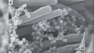 Imágenes inéditas revelan cómo el SARS-CoV-2 invade las vías respiratorias