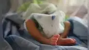 El insólito caso del bebé que nació con tres penes