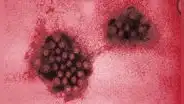 Norovirus, el patógeno resistente al alcohol que se propaga con rapidez en Inglaterra
