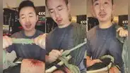 TikTok viral: doctor tiktoker enseña primeros auxilios para heridos ante contexto de guerra