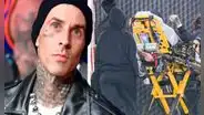 Travis Barker fue hospitalizado por pancreatitis tras realizarse colonoscopia