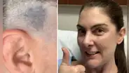 Fue a cortarse el cabello y su estilista notó algo que le salvó la vida: “Realmente me asustó”