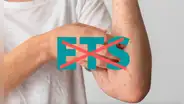 ¿Por qué la viruela de mono no es una ETS ni una enfermedad exclusiva de la comunidad LGTB?