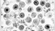 El virus potencialmente letal que vive en el 95% de los seres humanos