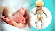 ¿Por qué los bebés al nacer tienen más huesos que los adultos?