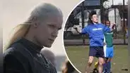 Matt Smith, la estrella de “House of the dragon” que dejó el fútbol por una extraña enfermedad