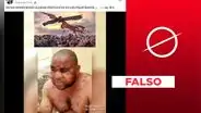 Video viral muestra a paciente con viruela del mono, no con “efectos de las vacunas”