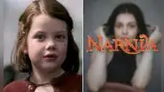 Actriz de “Las crónicas de Narnia” casi muere por bacteria come carne y expone sus secuelas