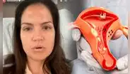 ¿Por qué Lorena Álvarez tuvo que someterse a una cirugía de extirpación de útero a sus 38 años?