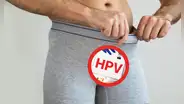 ¿Cómo detectar un pene con el virus del papiloma humano?