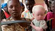 Niño albino fue hallado muerto y desmembrado en presunto ritual mágico en el Congo