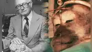 El experimento más cruel del doctor Robert White: trasplantó la cabeza de un mono a otro cuerpo