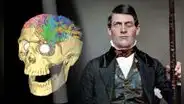 Phineas Gage: el hombre que vivió 12 años con un hueco en el cráneo por una varilla de metal