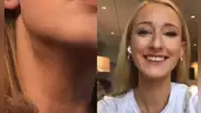 Joven descubre que tiene cáncer en etapa 4 después de realizar truco de belleza viral de TikTok