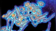 Guinea Ecuatorial declara alerta sanitaria tras confirmar 9 fallecidos por el virus de Marburgo
