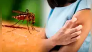 ¿Cómo quitar la picazón de un mosquito con remedios caseros?