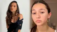 Alexia Barnechea se quiebra al revelar el severo acné que padece: “Voy a cuidar de mí”