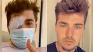 Joven durmió con los lentes de contacto puestos y un parásito se comió su ojo: Fue un dolor inexplicable