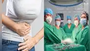 Mujer que sufría fuertes dolores en el abdomen tenía tumor de 8 kilos