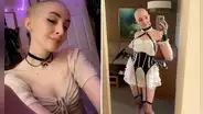 OnlyFans: joven usa ganancias para tratarse contra el cáncer y dice que sus fans "aman su look calvo"